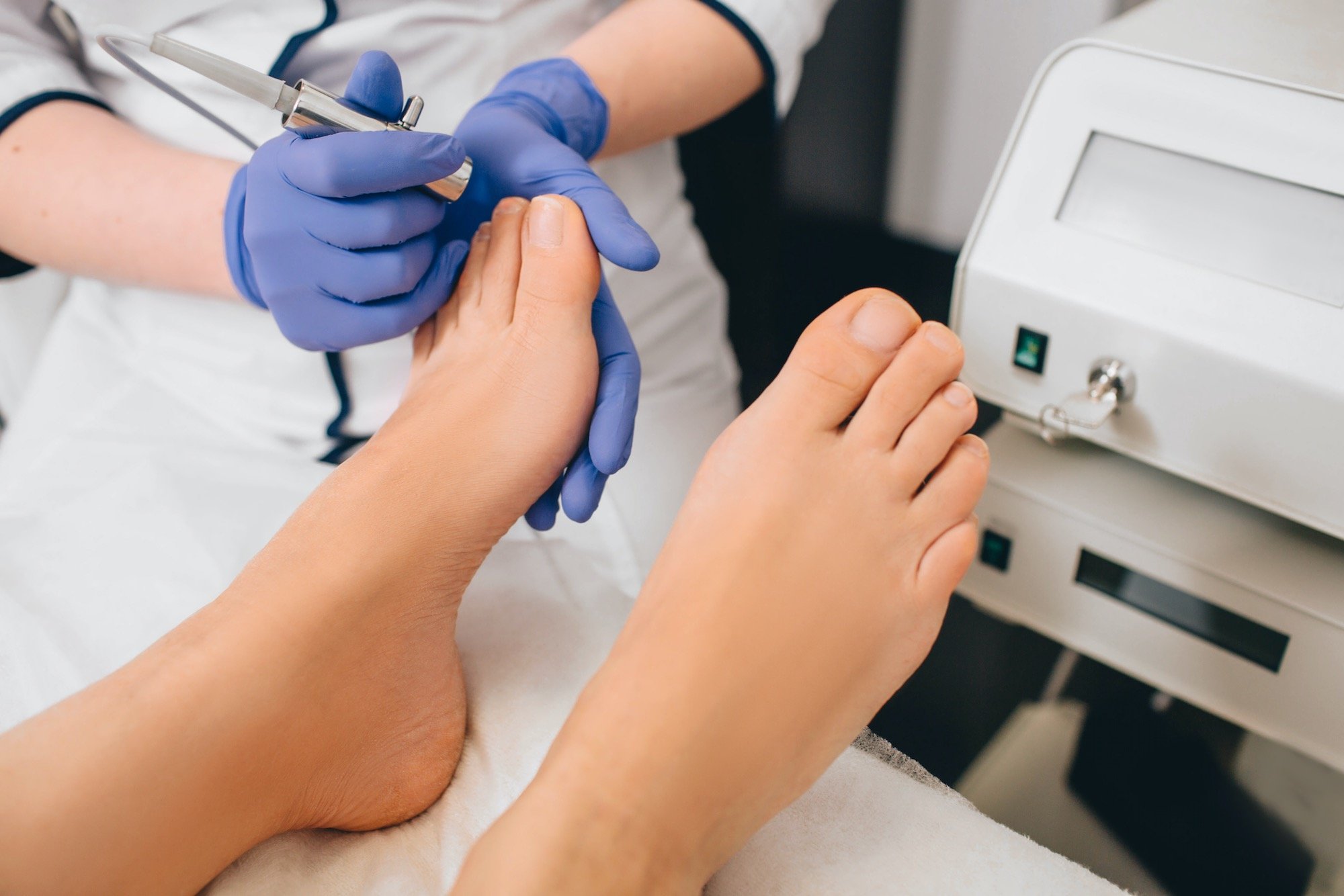 laser-fungus-removal-woman-evaluating-mans-nails_afd Young Patient in Podiatry Office Addressing Nail Fungus