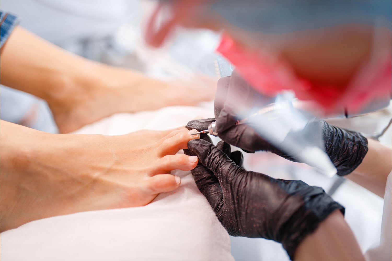Cleaning woman's nail to evaluate types of toenail fungus