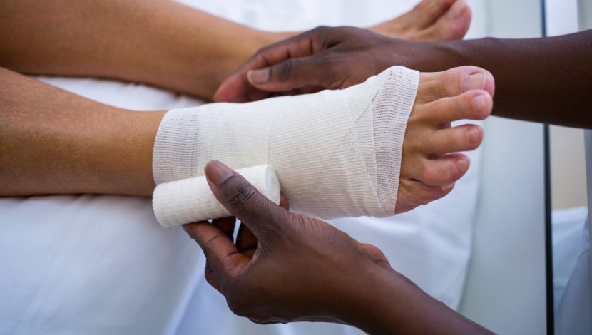 Podiatrist bandaging a sprained ankle after patient feels burning sensation