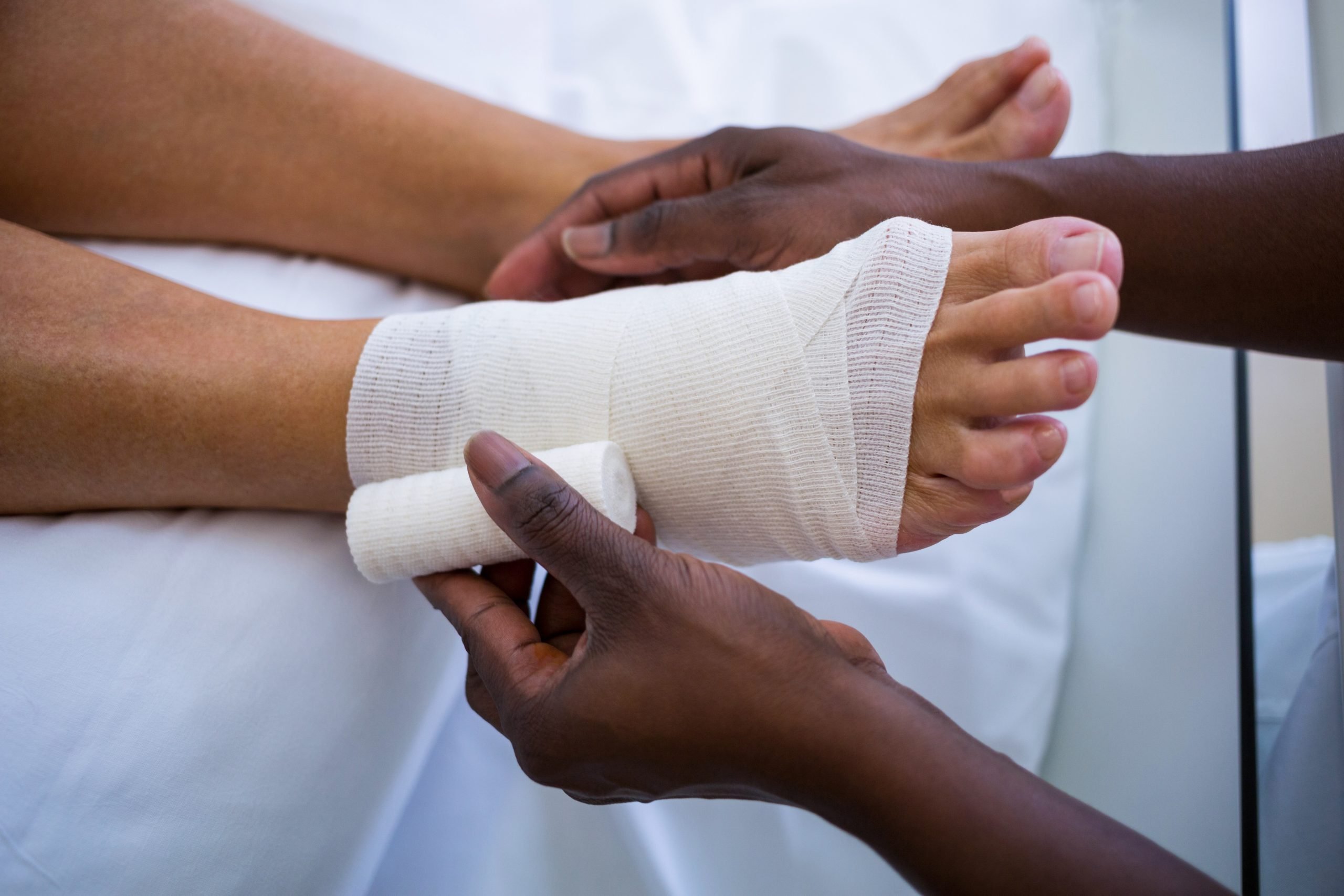 Podiatrist bandaging a sprained ankle after patient feels burning sensation